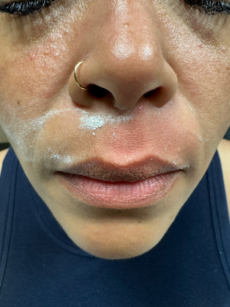 Upper Lip Wax