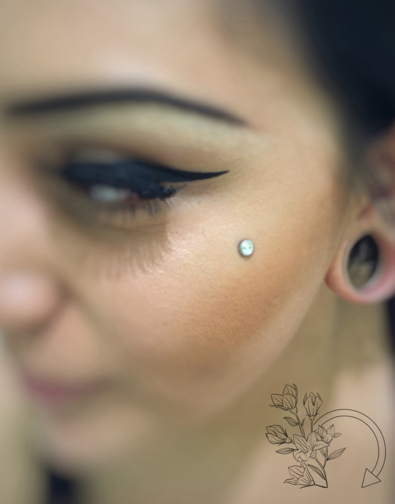 Single Micro-Dermal