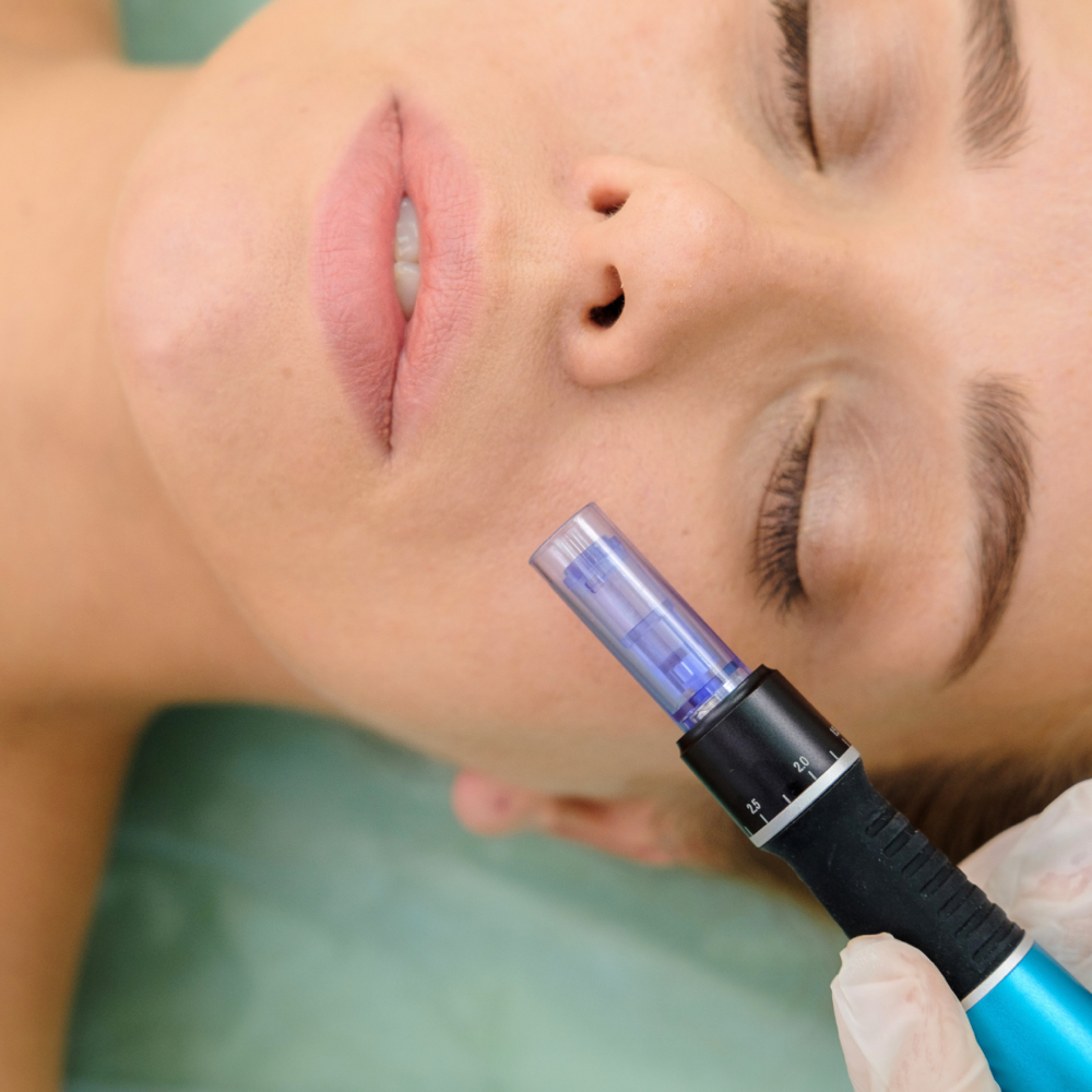 NanoInfusion Facial