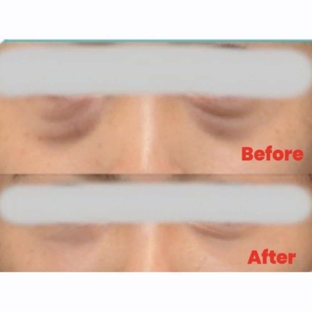 Rejuvenating Eye Treatment at Sun Skincare LLC in Scottsdale, AZ