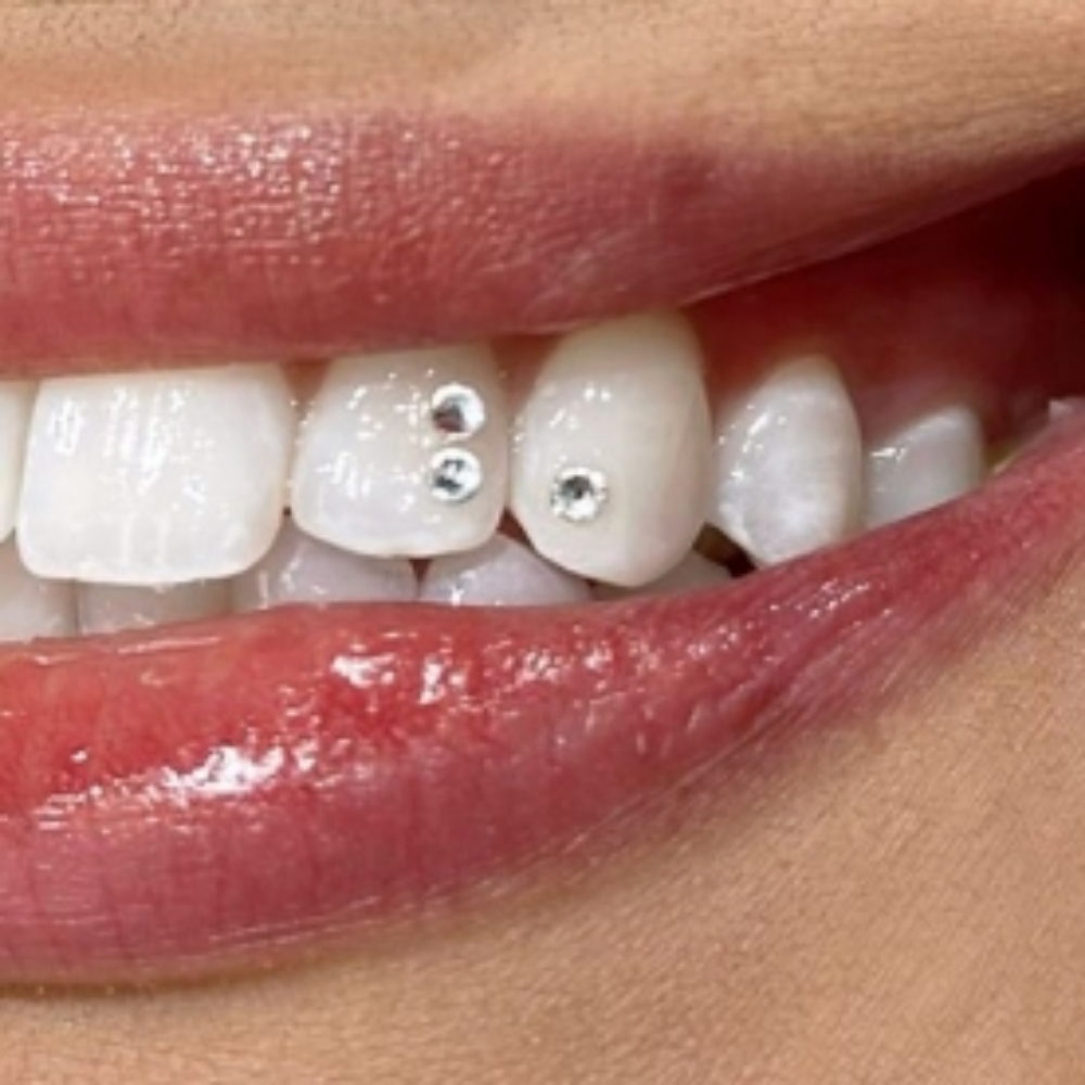 tooth gems at aurora sydel in Lakewood, CO