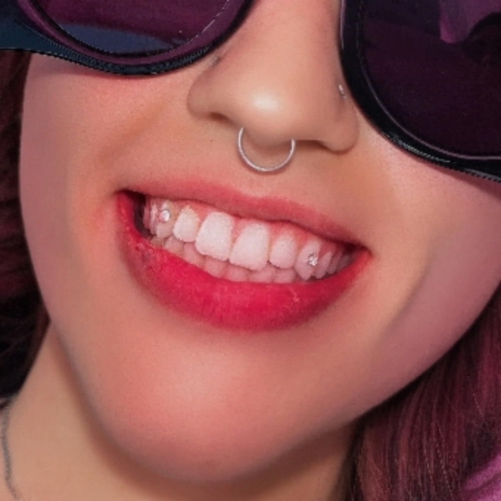 tooth gems at aurora sydel in Lakewood, CO