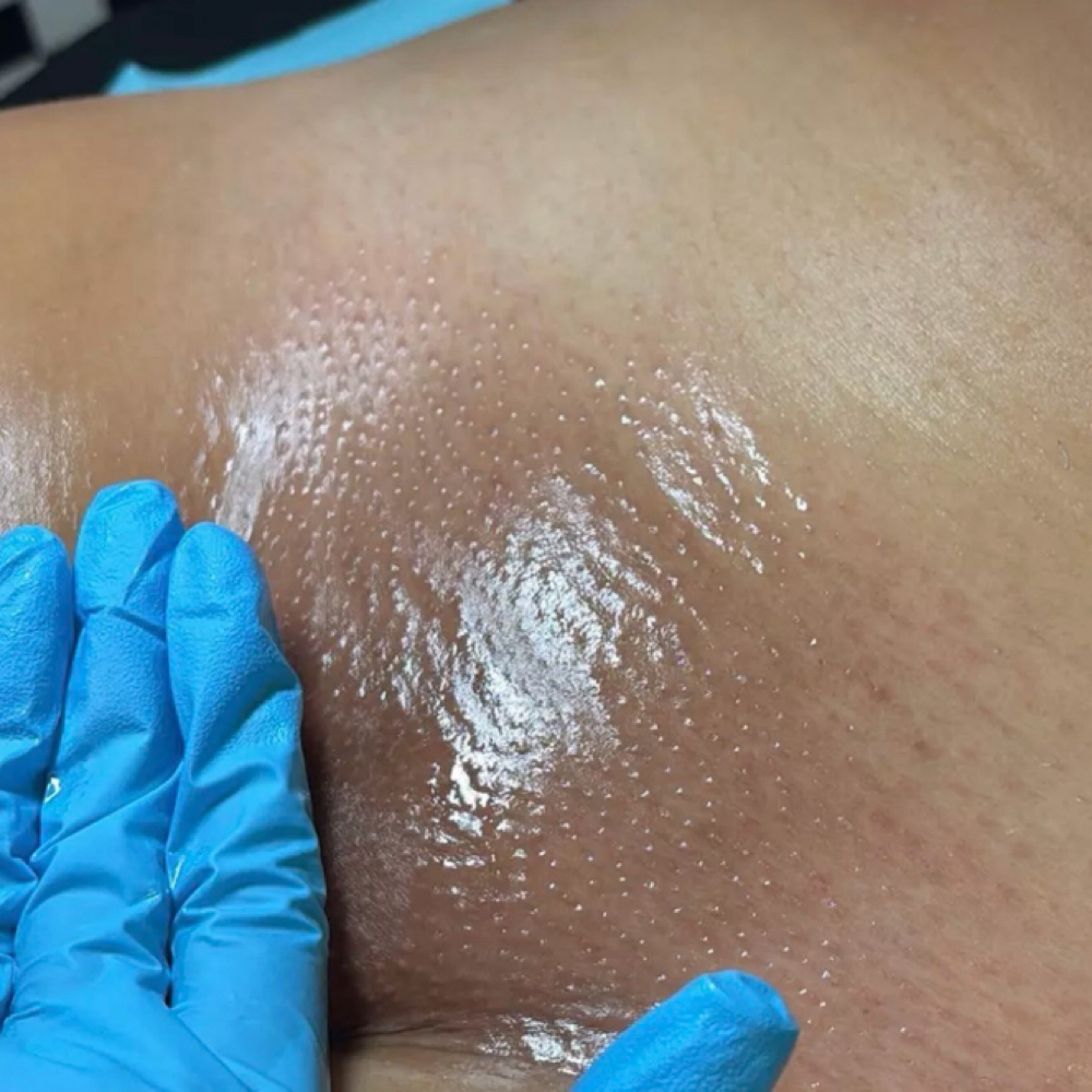 Brazilian at The Bare Studio Esthetics, LLC in Moline, IL