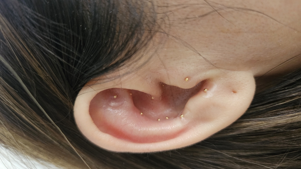 24K Gold Ear Seeding