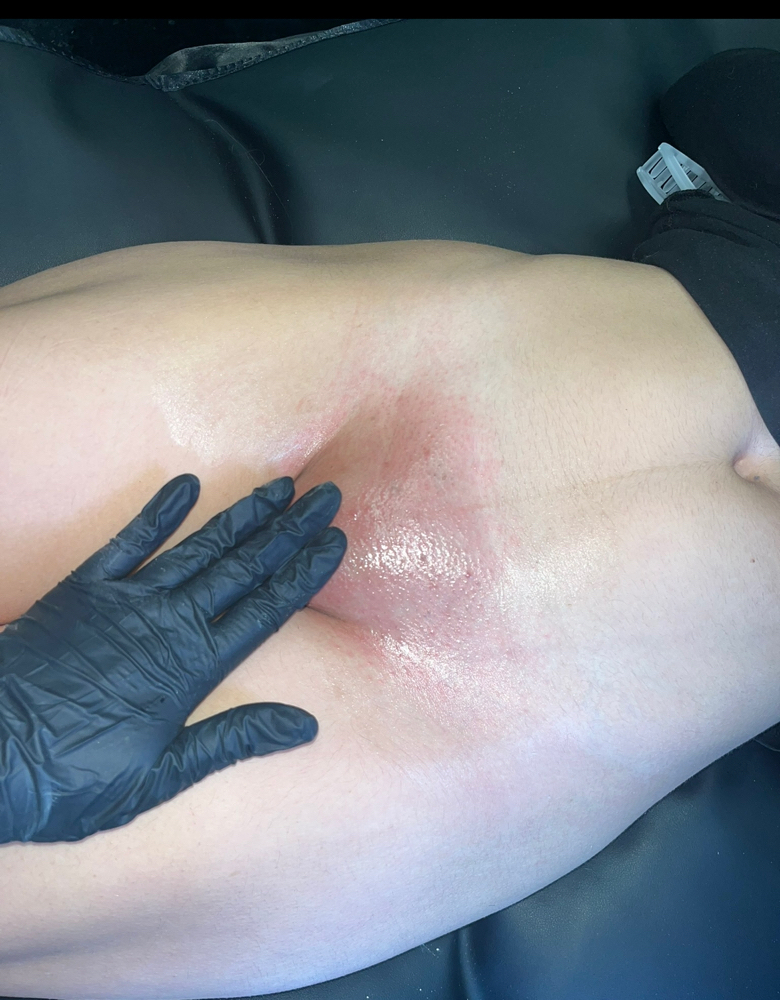 Brazilian Wax 4-6 Weeks