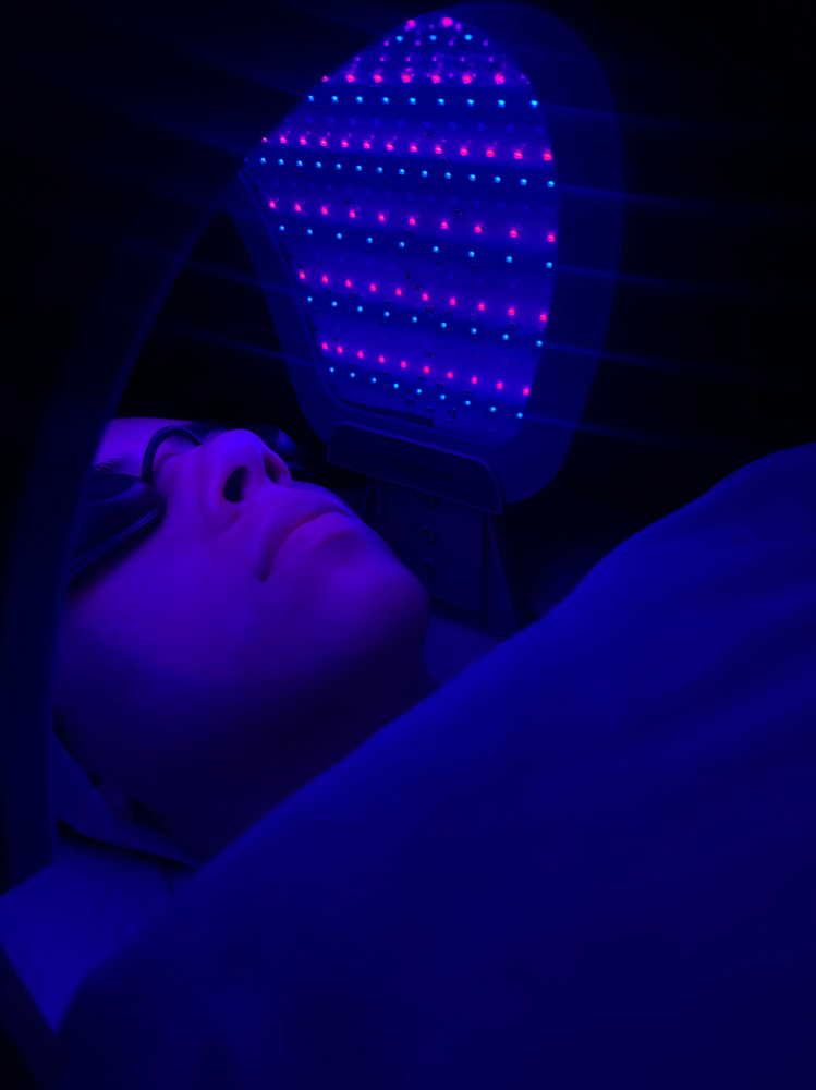 Korean Facial- Pdt Acne Treament
