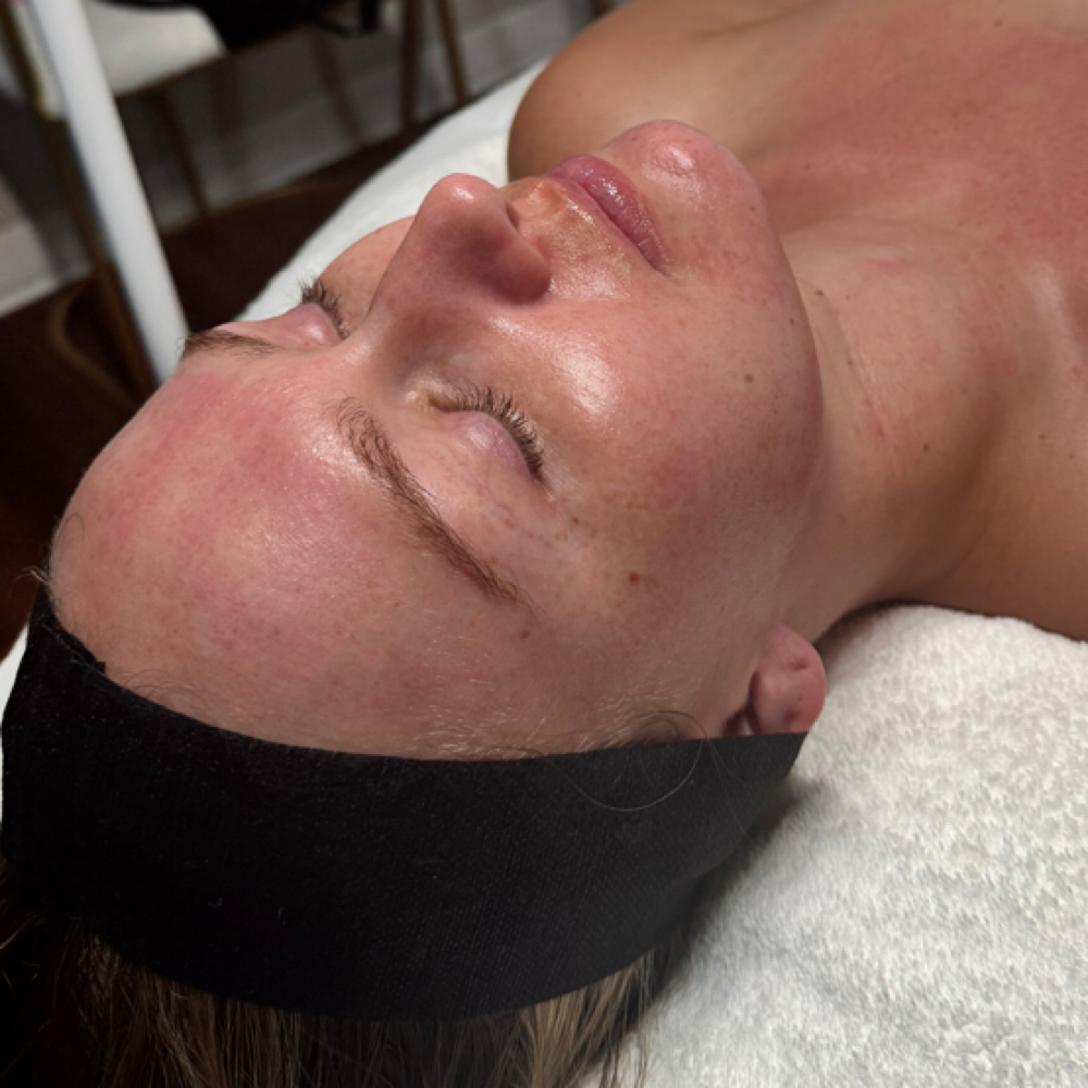Teen Facial at Celestial Aesthetics in College Station, TX