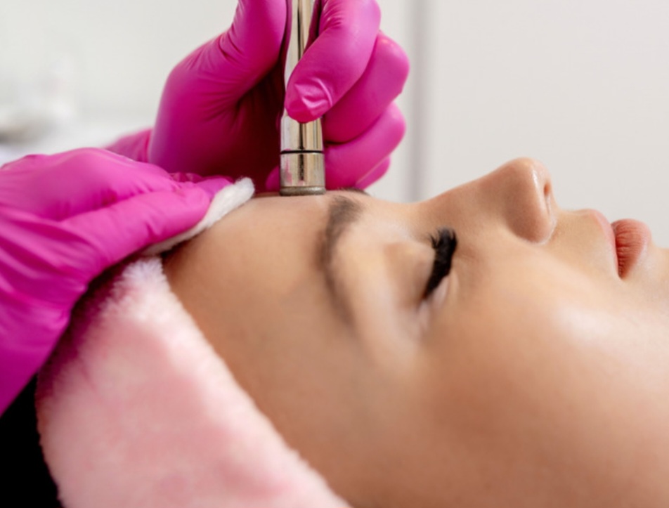 Microdermabrasion Facial