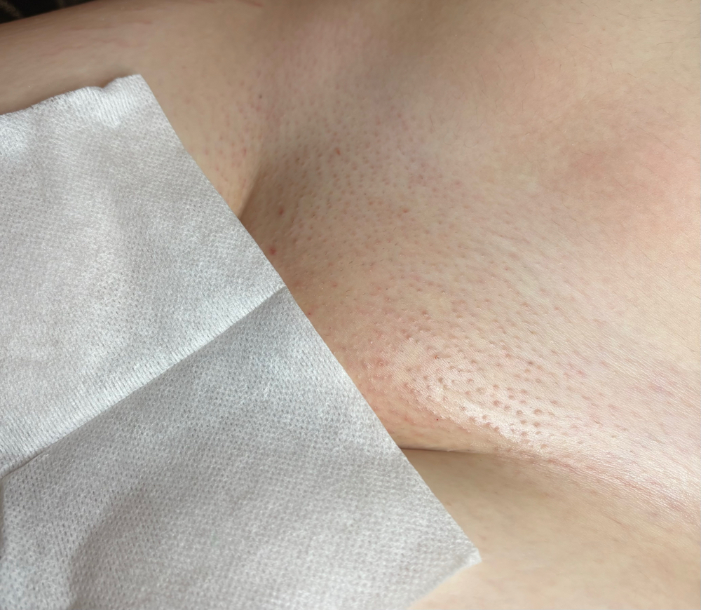 Brazilian wax FIRST time client