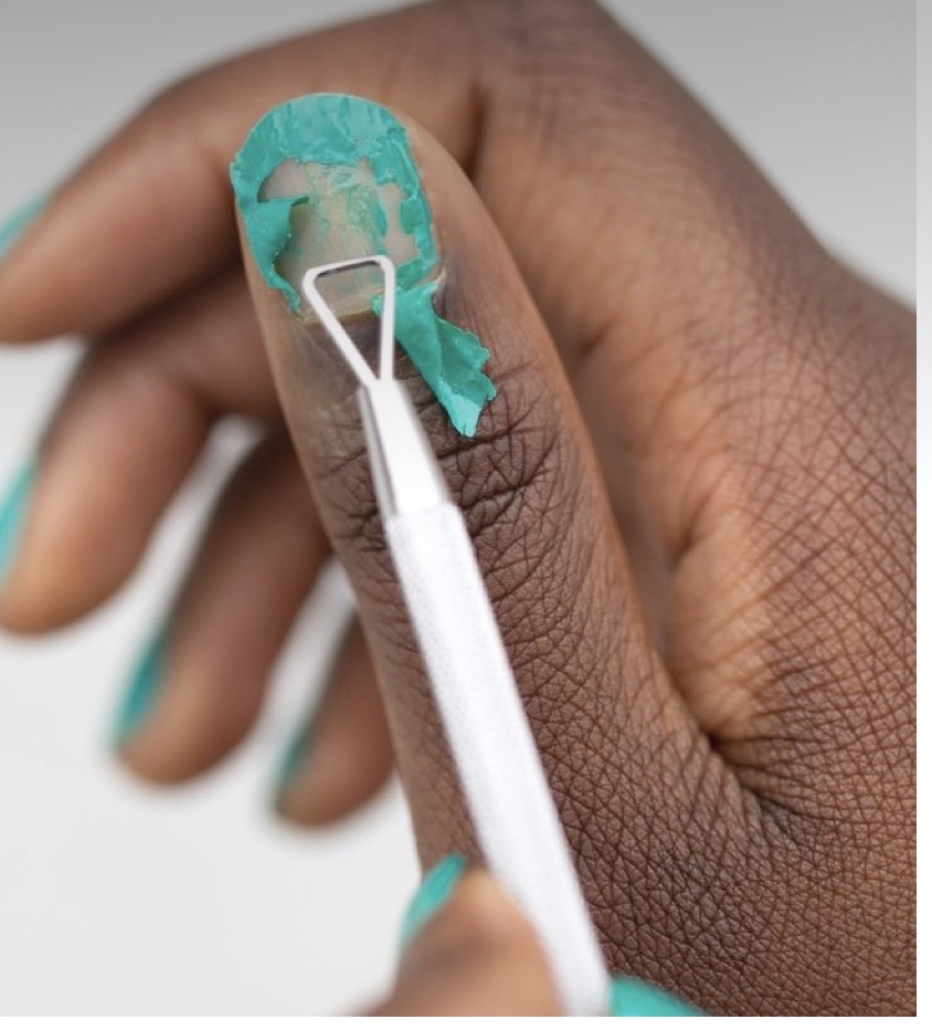 Gel Removal