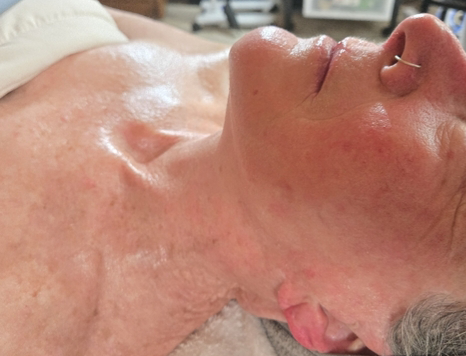 The Advanced Calming Facial