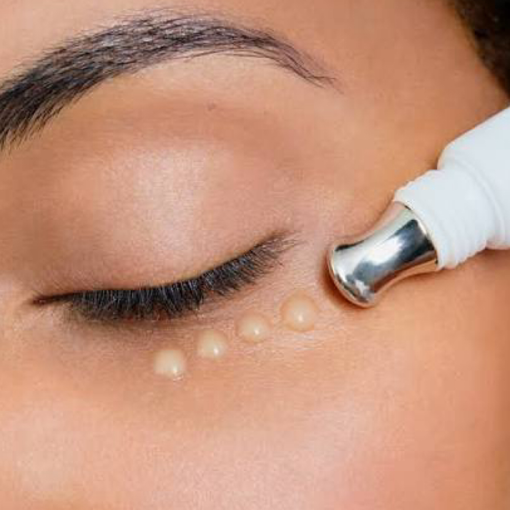 Eye Treatment at Yadis Nails & Spa Laser in Austin, TX