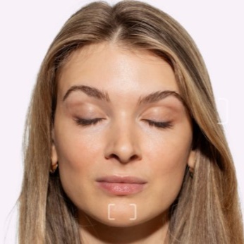 Dimpled Chin Tox at Injections by Leighanna in Clarksville, IN