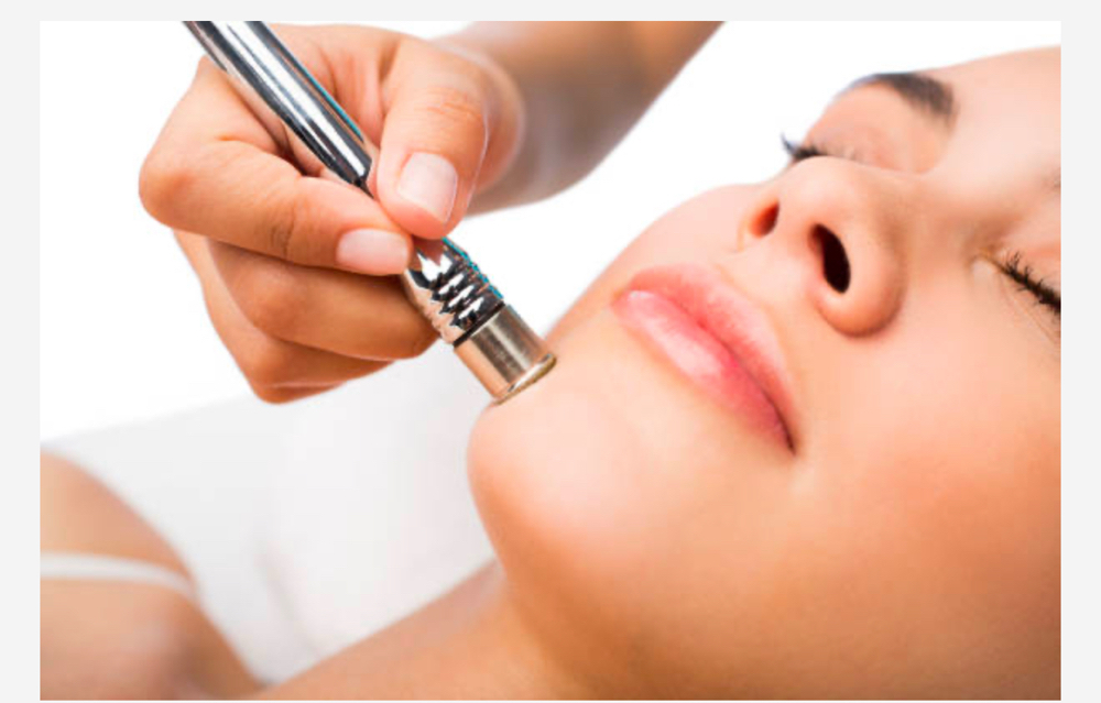 Diamond Microdermabrasion