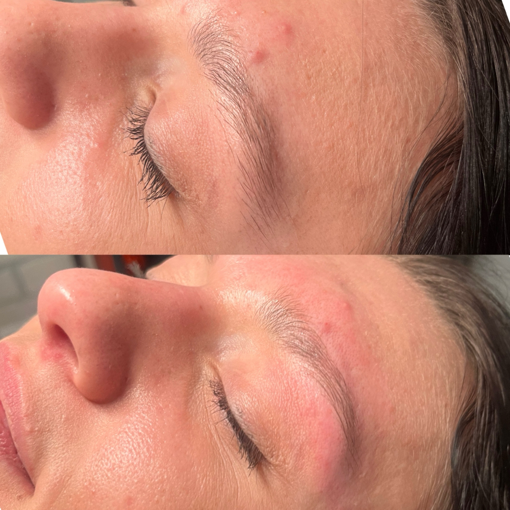 Brow Wax-  Teachers at Forever Young Esthetics in Alcoa, TN