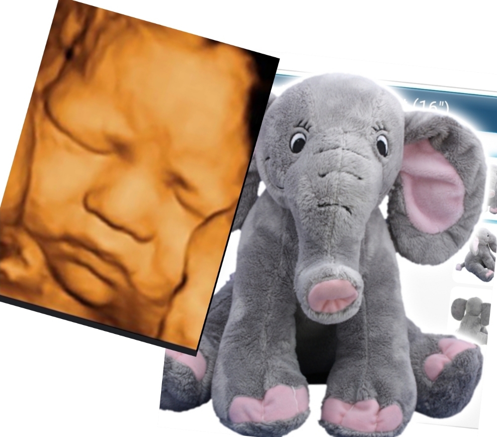 3D ultrasound & Heartbeat Bear