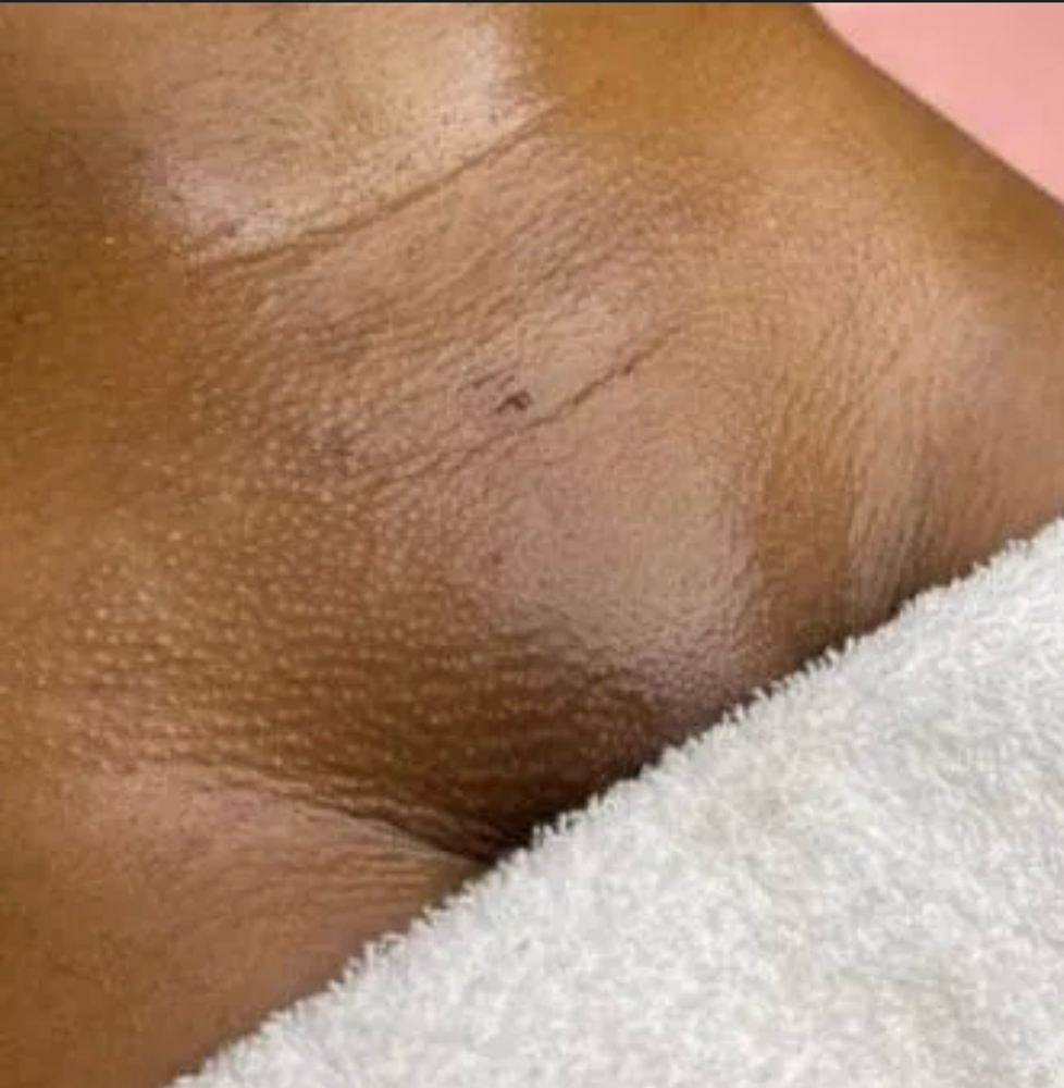Brazilian Wax