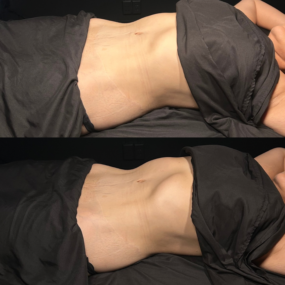 Flow & Release Treatment