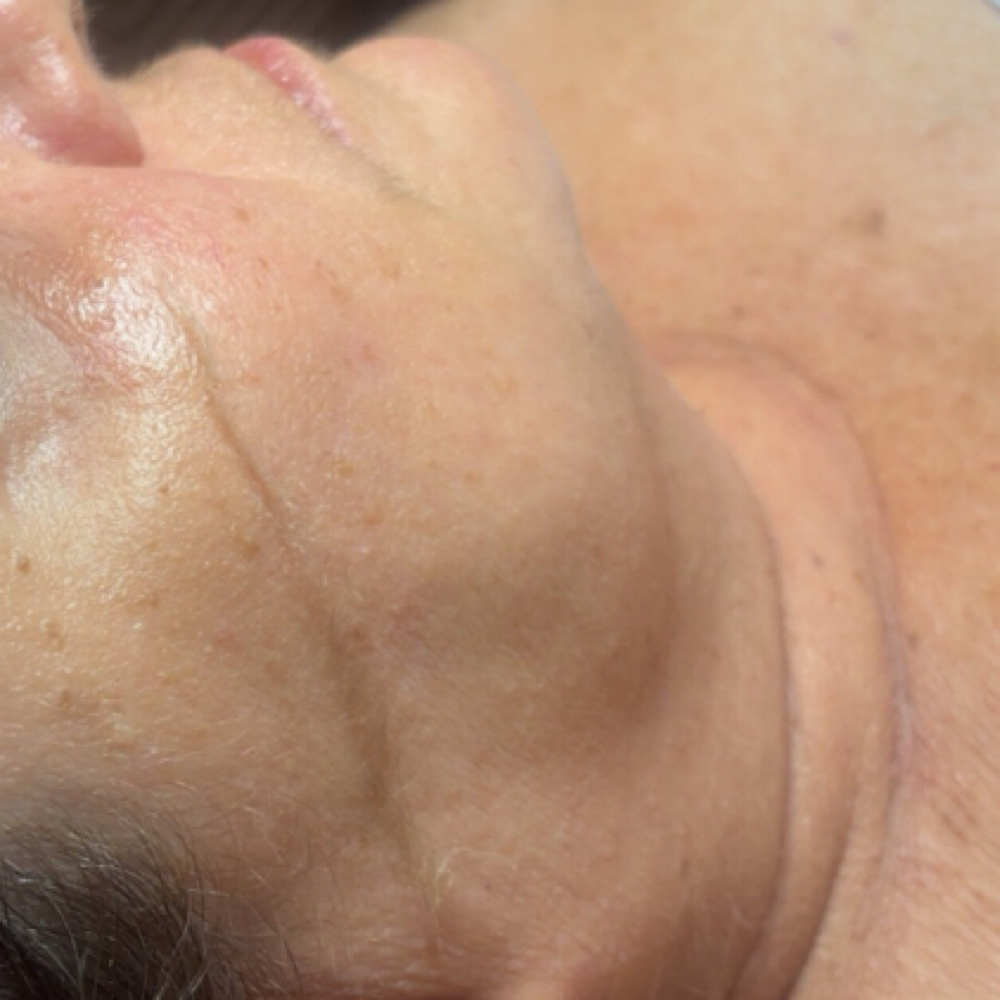 Dermaplane Facial at Complexions by Ali at Wild Roots Salon in Cape Girardeau, MO