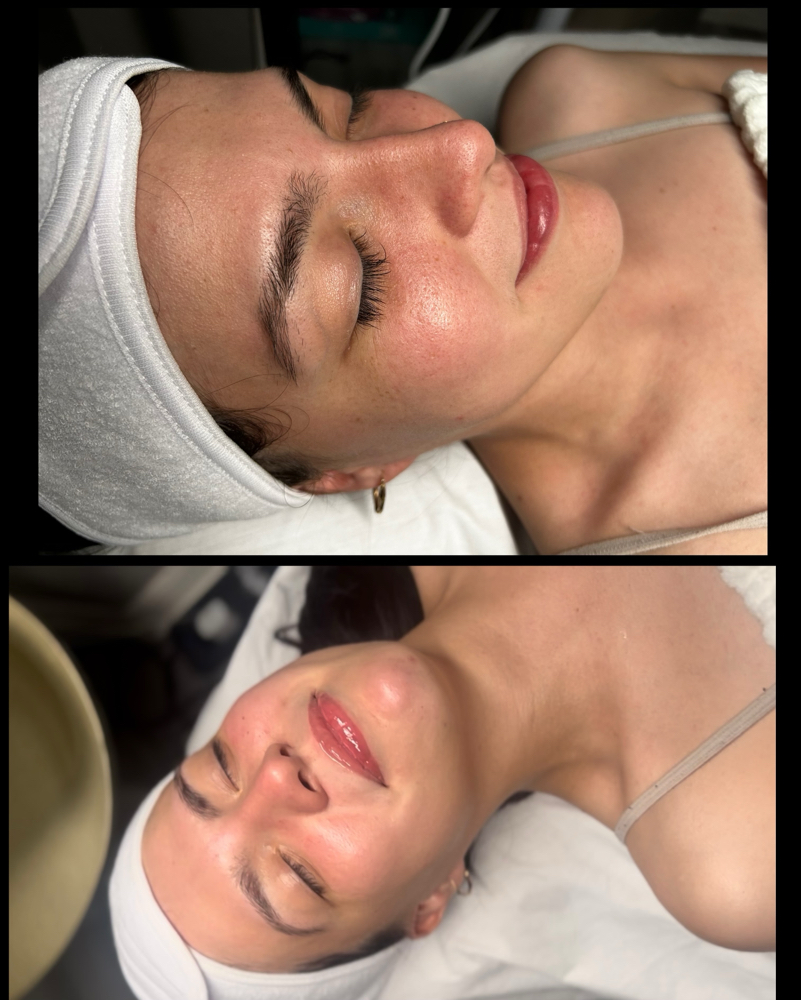 Glow Facial