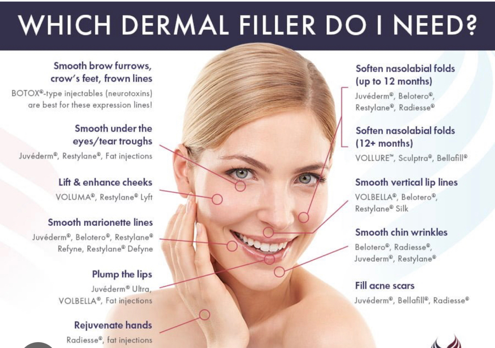 Dermal Fillers