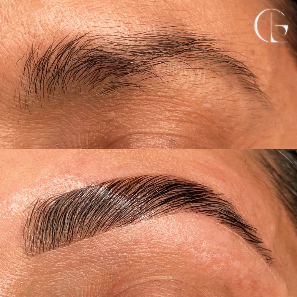 Brow Lamination