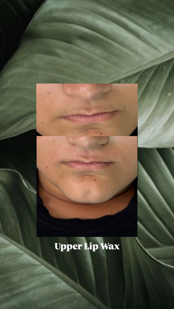 Upper Lip