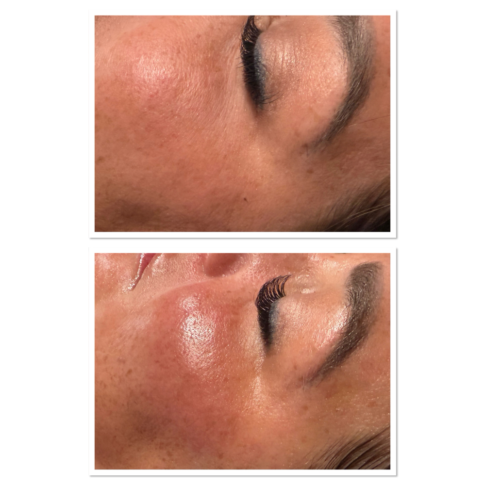 Ultra Lift Facial at GlowHaus Collective By Monét in Camden, AR