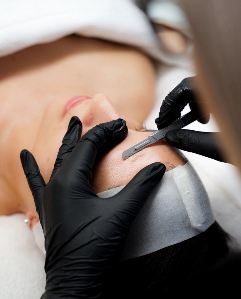 Dermaplaning