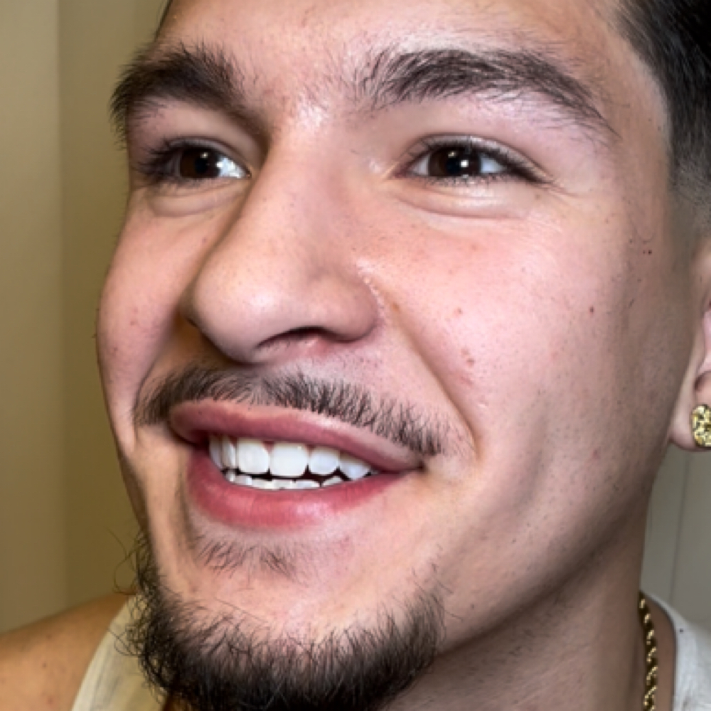 60-Min Teeth Whitening at Luxurious Enamel in Phoenix, AZ