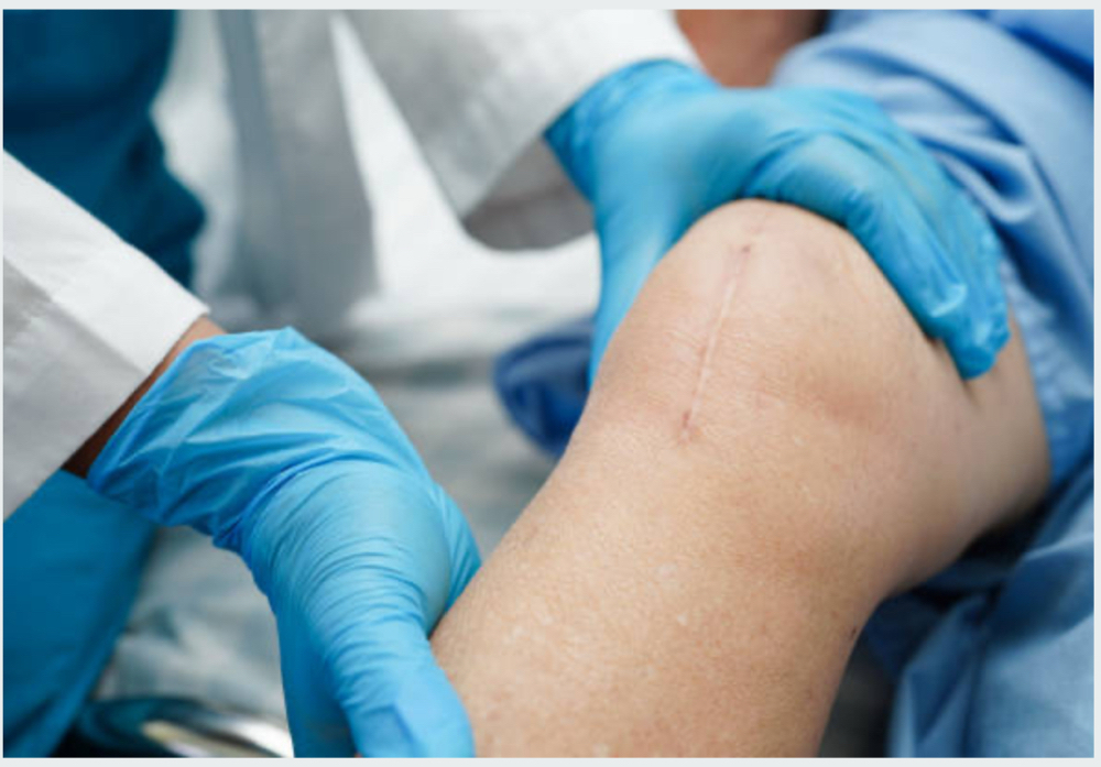 Injury Specific 30 Minute Session