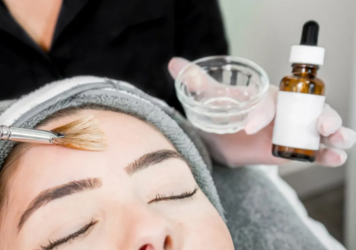 Chemical Peel
