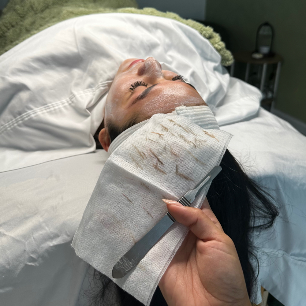 dermaplaning facial at softlife.esthetics in kennewick, WA