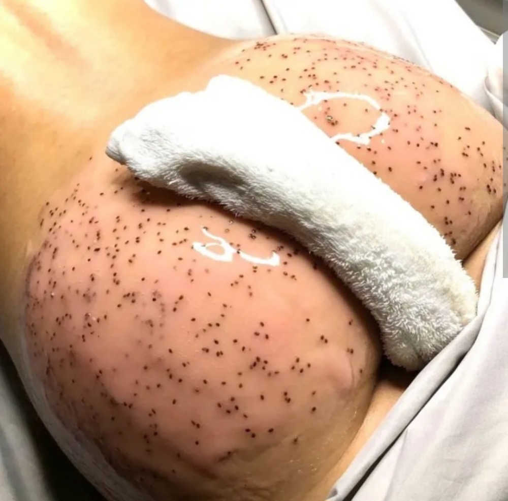 Fanny Facial