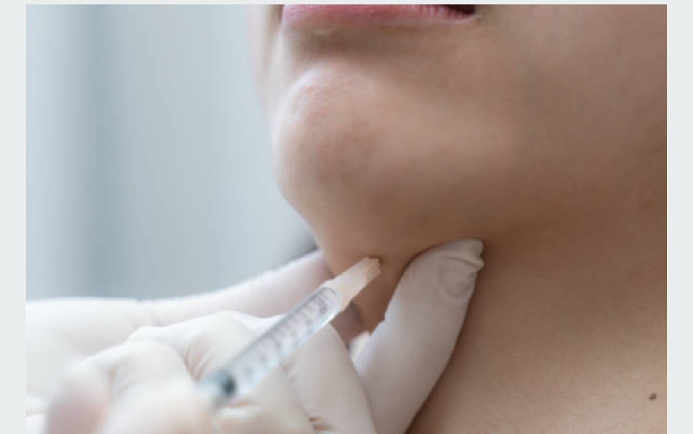 Liquid Lipo Chin