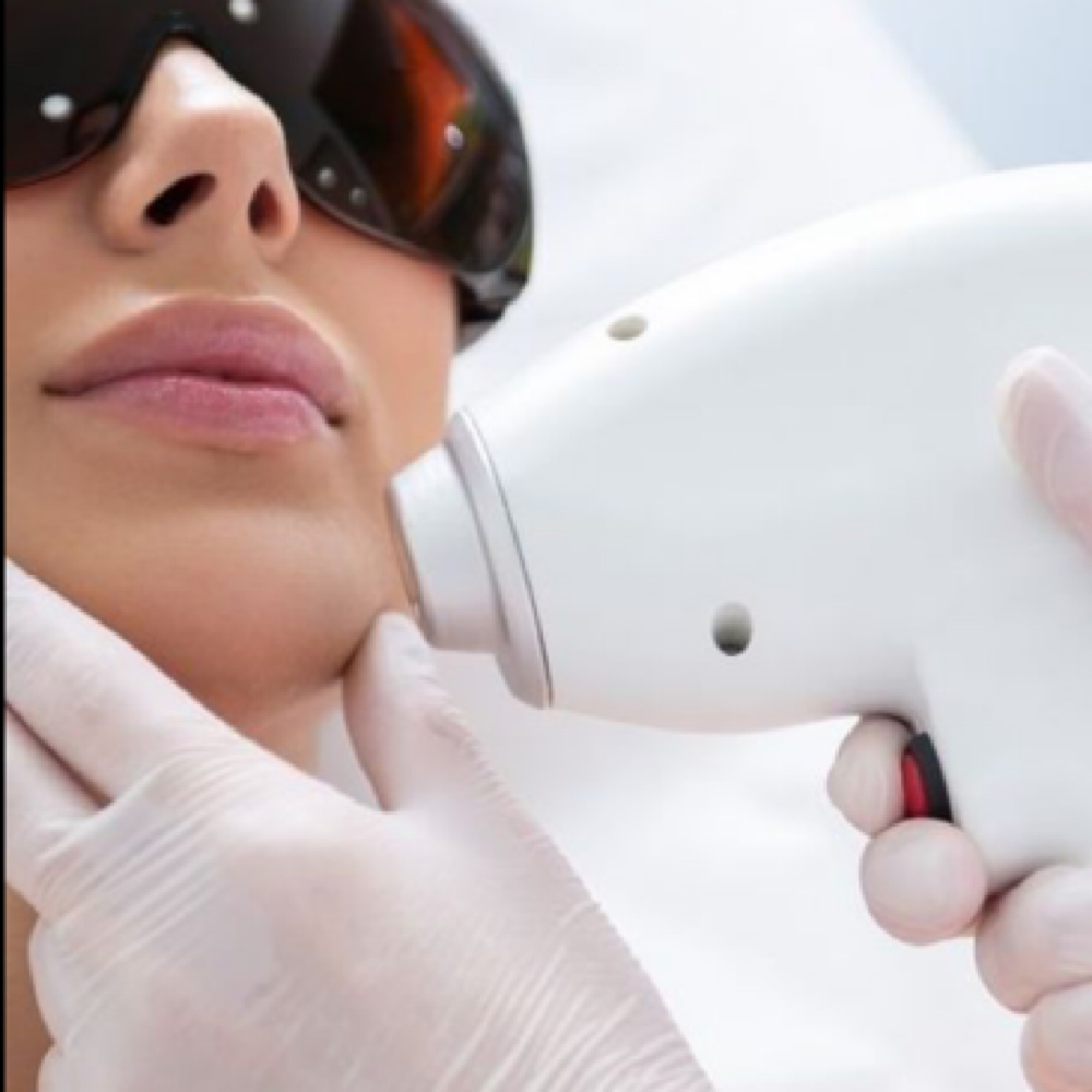 LHR Small Area at A&A Beauty Bliss in Cape Coral, FL