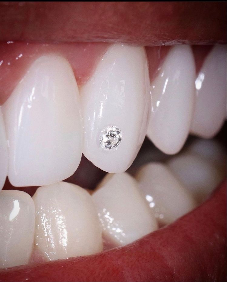 Tooth Gem (per Gem)