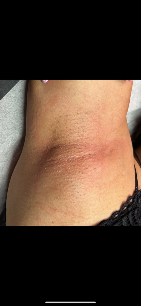 Underarm Wax