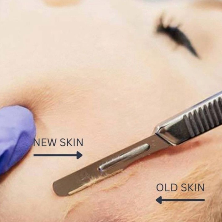 Dermaplaning treatment at The Glow & Care Spot in El Monte, CA
