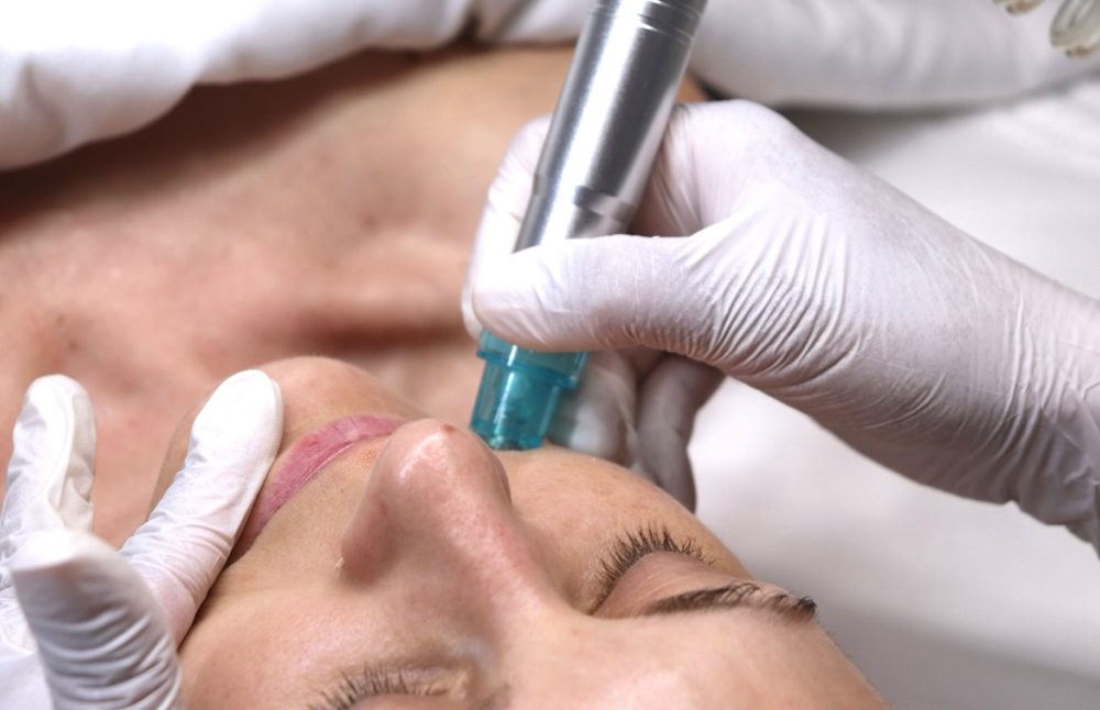 Deluxe Hydrofacial + Microderm