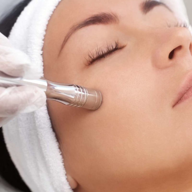 Microdermabrasion