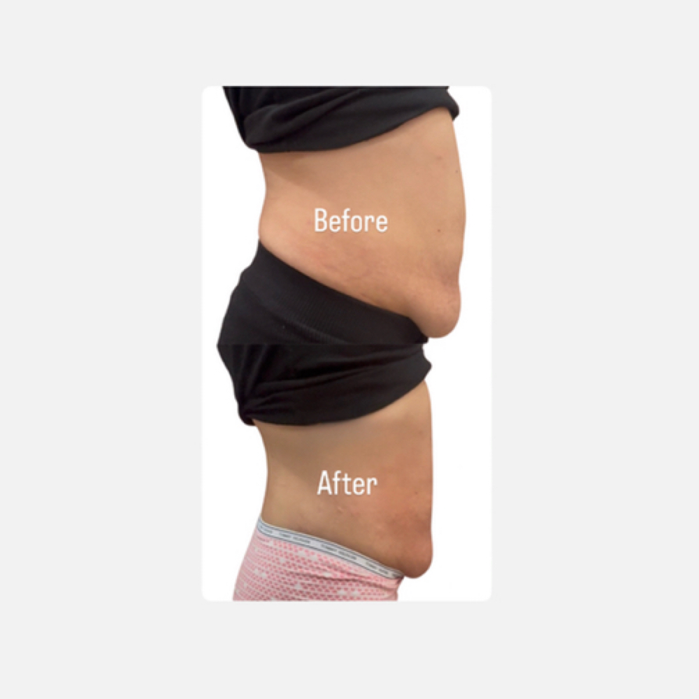 Body Sculpting at Boujae Beauty Bar in Philadelphia, PA