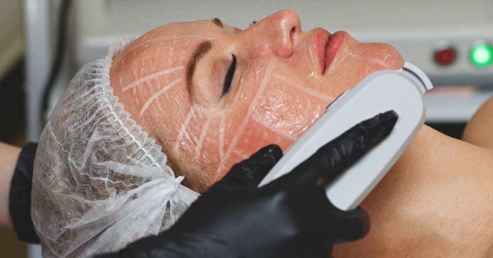 Monthly Sale 5 HiFu Facelift