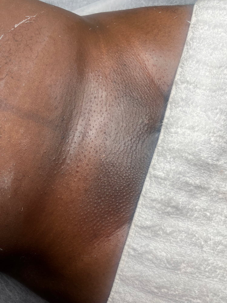 Mens Brazilian Wax