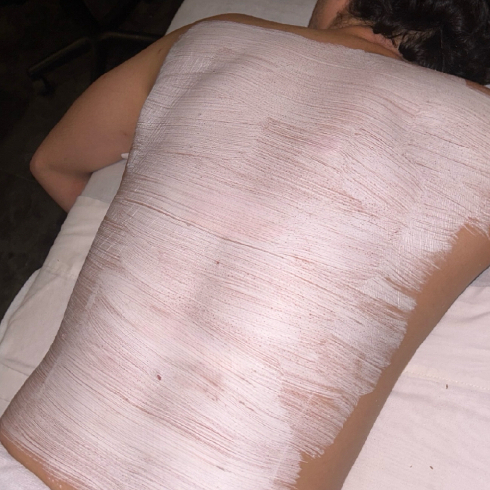 The Back Facial at Golden Moon Esthetics, LLC in Frisco, TX