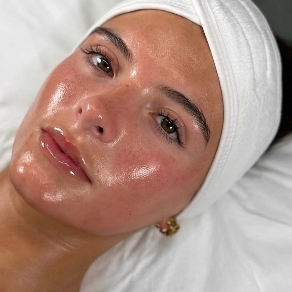 SALMON DNA TREATMENT at AESTHETICSBYNATALY in Alhambra, CA