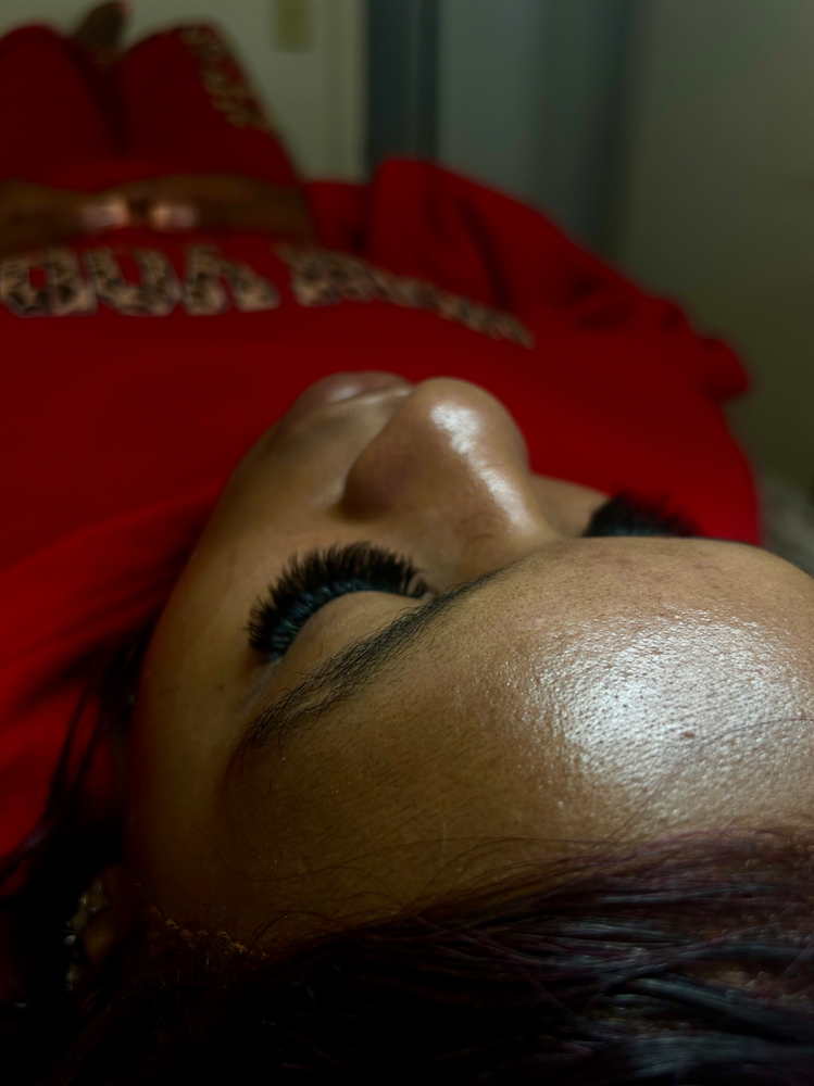 Mega Fill at Green Rose Esthetics in South Jordan, UT