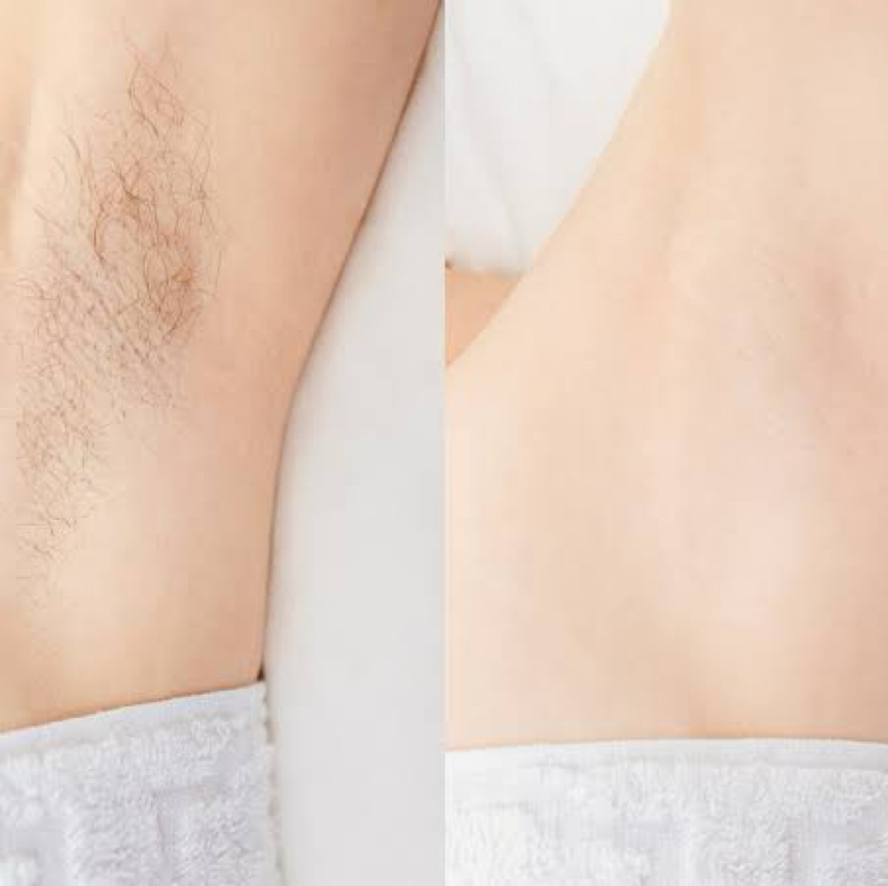 Underarm Wax at Angelic Skin & Body in Oak Park, IL