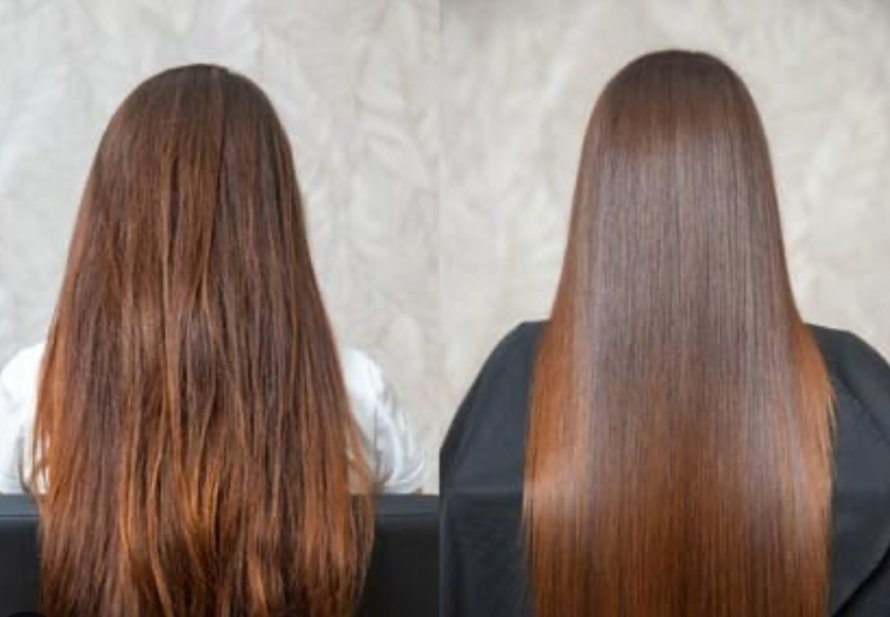 Nanoplastia at NIKI LAB Studio in Feasterville-Trevose, PA