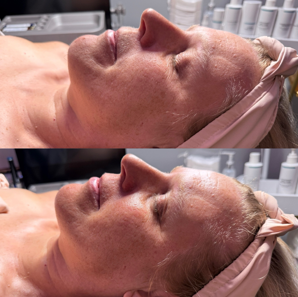 Parisian Glow | Customized Age-Well at TesSpa in Issaquah, WA